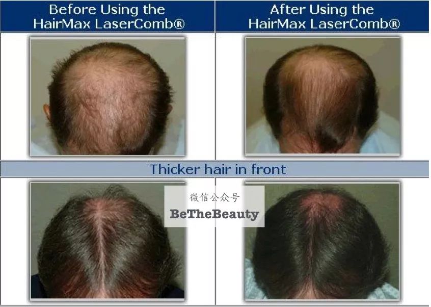 想为颜值偷偷加分？但只有10%的人会机智地修饰这里诶！