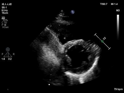心动在线怎么没有了,心动在线观看