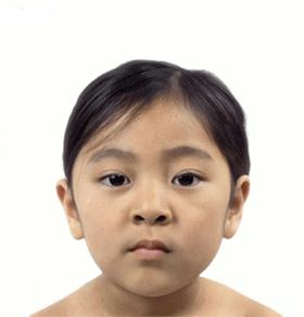 3·8变最美女神，欠肌肤一次美丽约会！——兖州区中医院光子嫩肤优惠活动