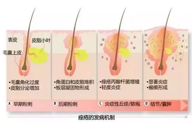 luna洁面仪选哪款,luna洁面仪用哪一款