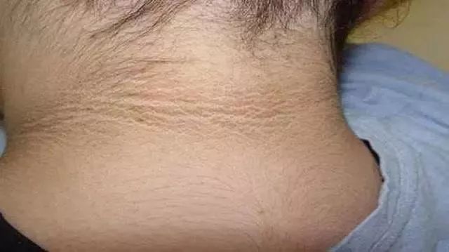 男孩子脖子黑洗不掉怎么办,男孩脖子老是不舒服是怎么回事