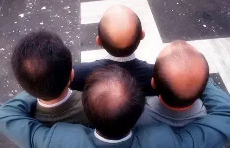 预防脱发和让头发变多的方法,春季脱发吃什么好得快