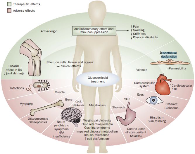 《自然》：糖皮质激素到底是抗癌还是促癌？科学家发现糖皮质激素会促进乳腺癌远端转移，或为精神压力导致癌转移原因|科学大发现