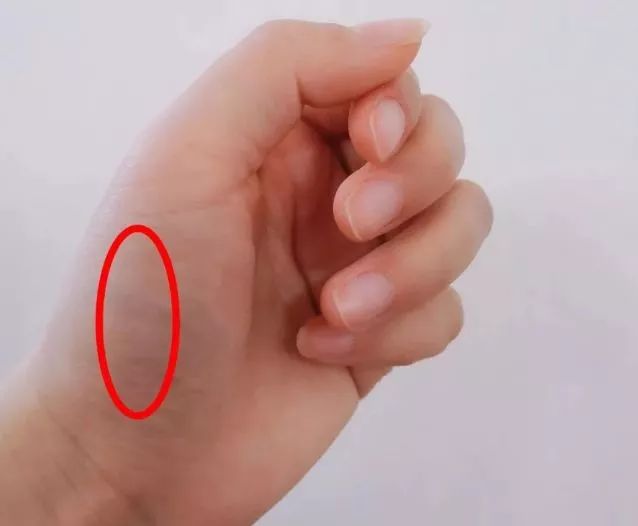 手上突然有青筋是什么原因,突然看到手上有青筋什么原因