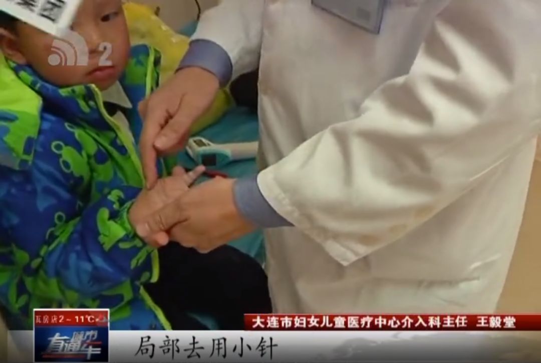 帮忙大小王|留守儿童手肿像水球大王帮忙查明病因