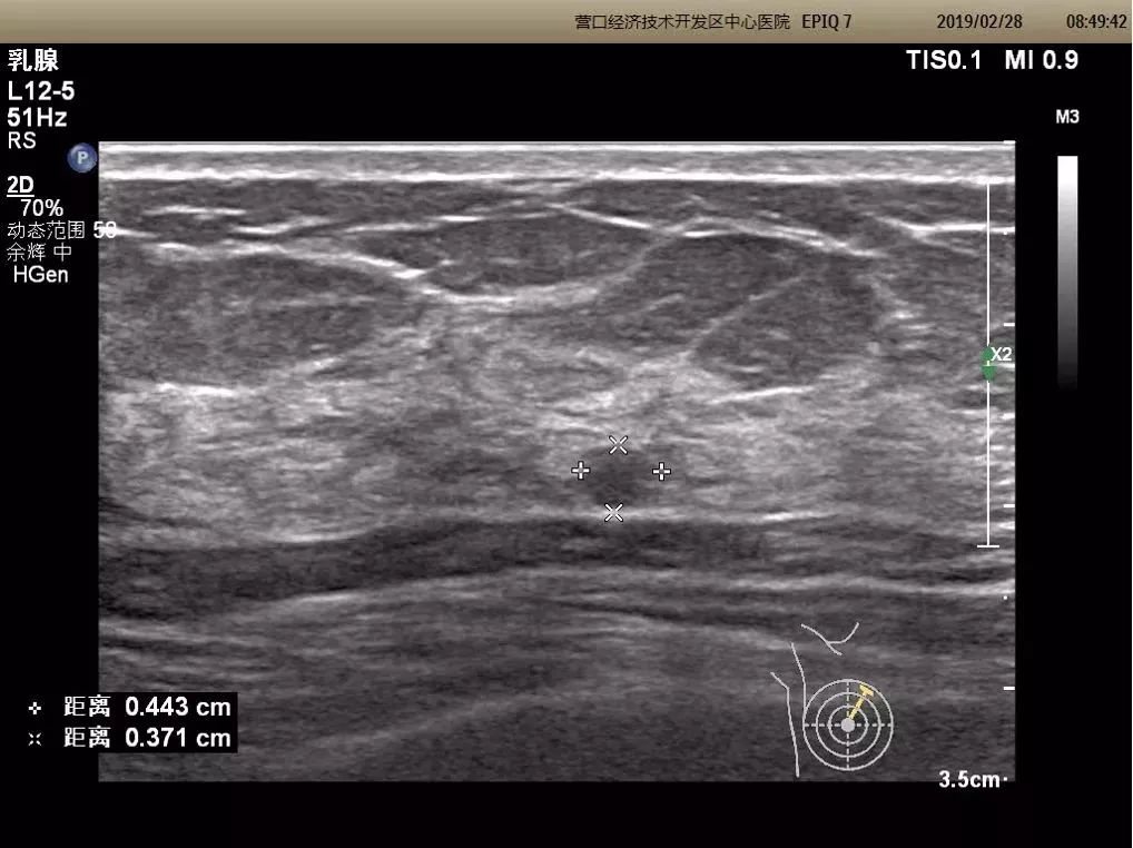 医院超声科新引进设备宣传,营口市中心医院分院彩超室