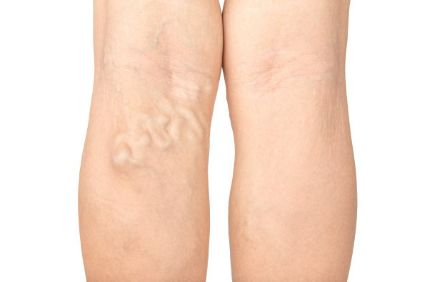 麻范儿好物|只要1秒！让你粗糙双腿变得又细又嫩！