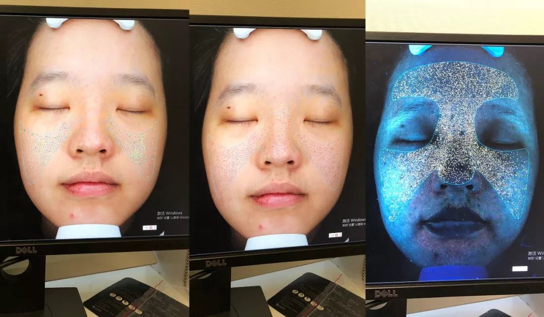 假小子变装惊艳全场的样子,肿眼泡假小子