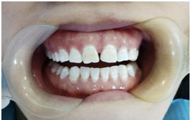 口腔医院皓齿,皓齿美白诊室流程