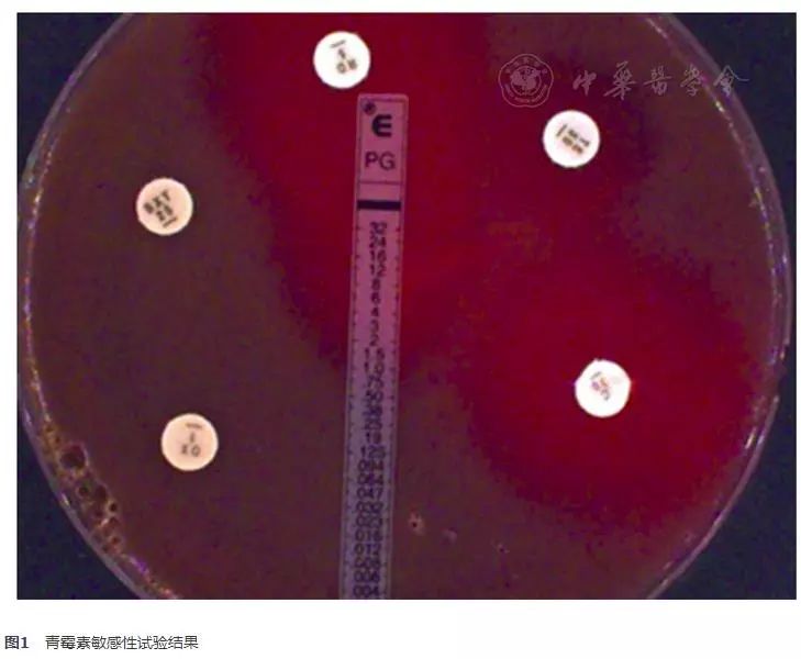 肺炎链球菌危险因素分析 (肺炎链球菌的耐药性分析)
