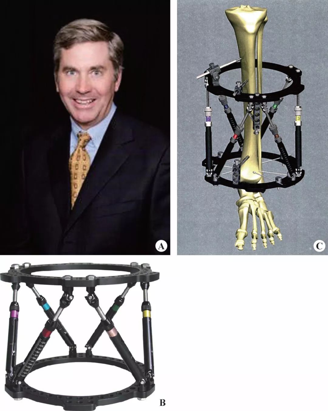 taylorswift支架,taylor外固定支架