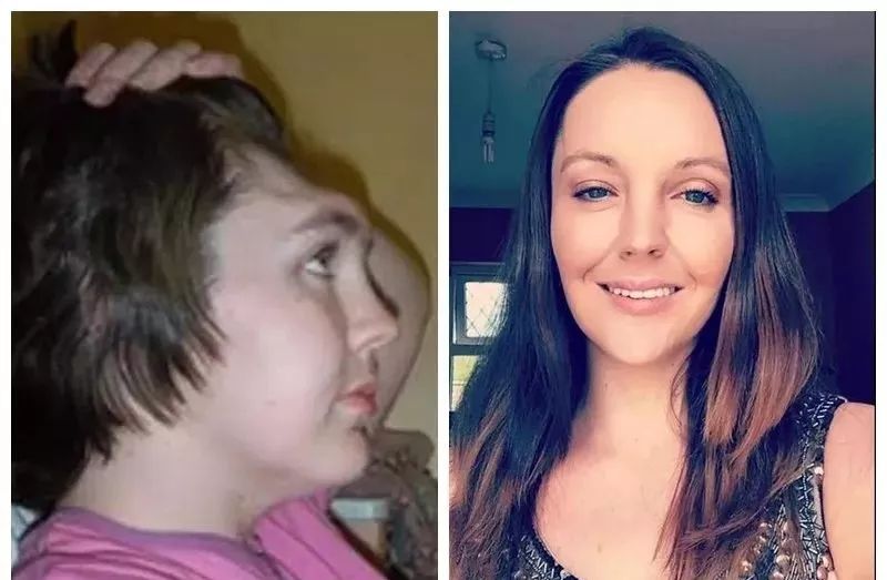 坐副驾把脚翘前档风玻璃,她前额都被膝盖戳没了!血的教训!