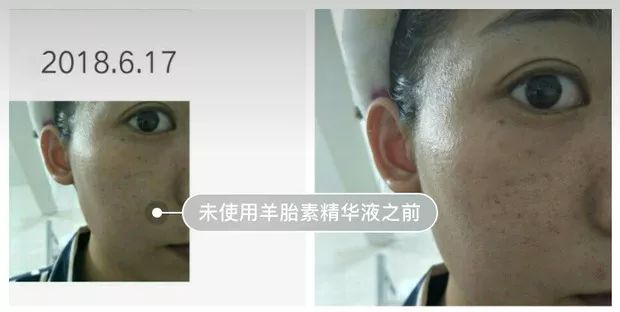 抗皱抗衰澳洲,大牌抗衰淡斑护肤品