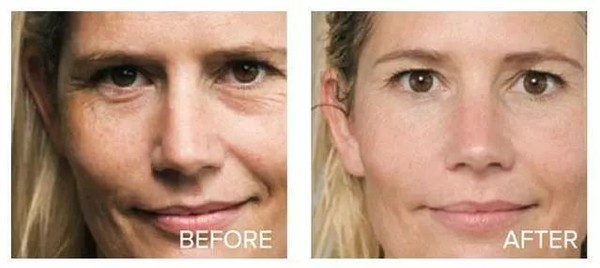 美白针产品成分,韩国美白针美白成分