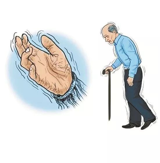 世界卒中日预防卒中我们在行动,如何预防老年痴呆或帕金森病