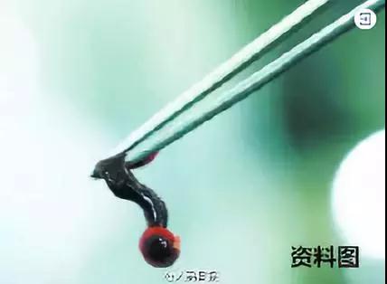 孩子7岁突然眼皮长了个黑点,2岁小孩眼睛上突然长了一颗黑痣