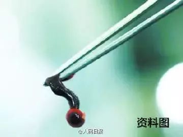 男童眼皮突然有了痣,小孩眼皮上突然出针尖大的红点