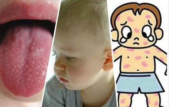 紧急提醒小孩用药,紧急提醒高发病