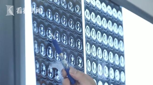 一个肾64万？34岁男子为还债卖肾连续被骗“医生”竟藏身网吧