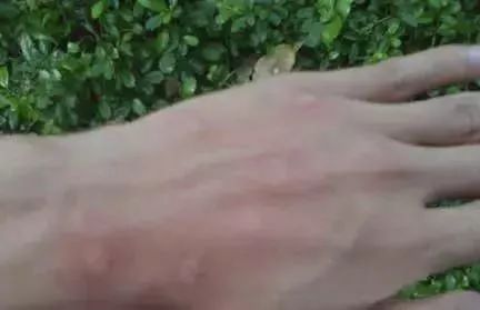 驱蚊手环儿童热门,驱蚊手环儿童款推荐