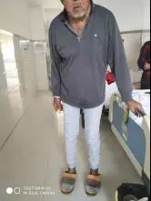 疮很常见，天疱疮你了解吗？