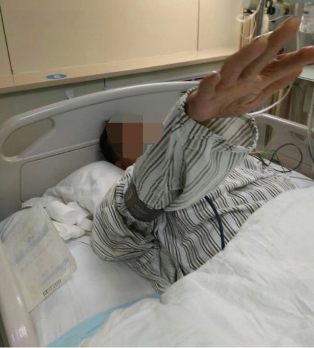 径技·例量|25期：再灌注出血—防不胜防