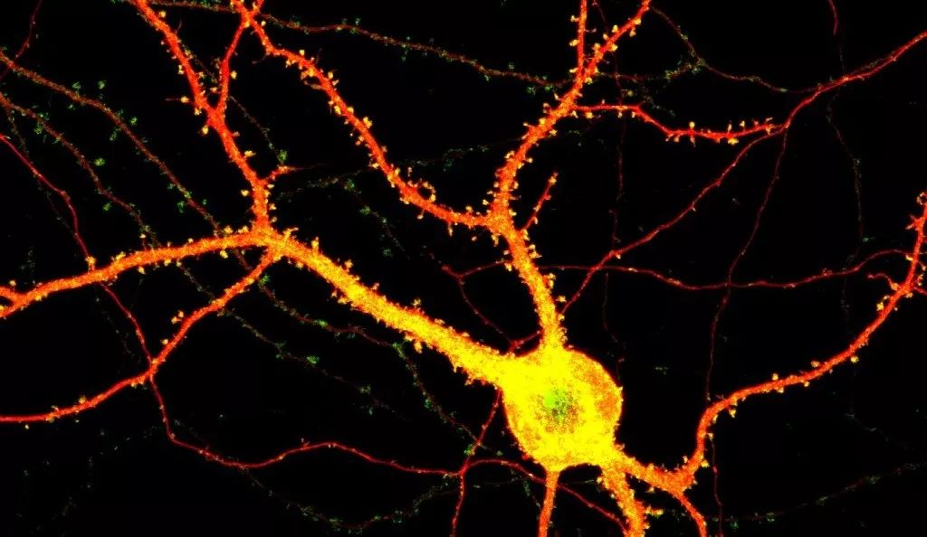 我们的城市病了怎么办,我们的城市病了英文视频