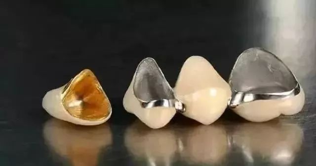 烤瓷牙和全瓷牙的内幕,烤瓷牙和全瓷牙普通人怎么区分