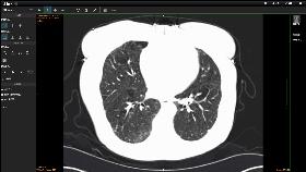 农场里走出CT鼻祖，美苏核危机诞生磁共振！