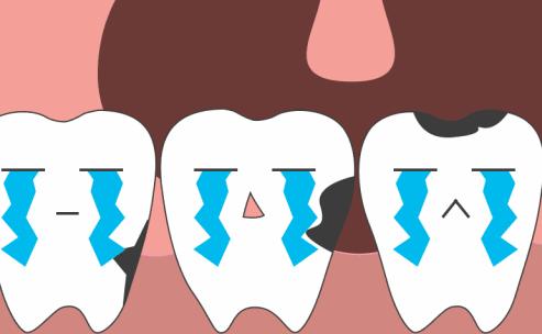 牙齿怎么会被虫吃,牙齿是怎么被虫吃的视频