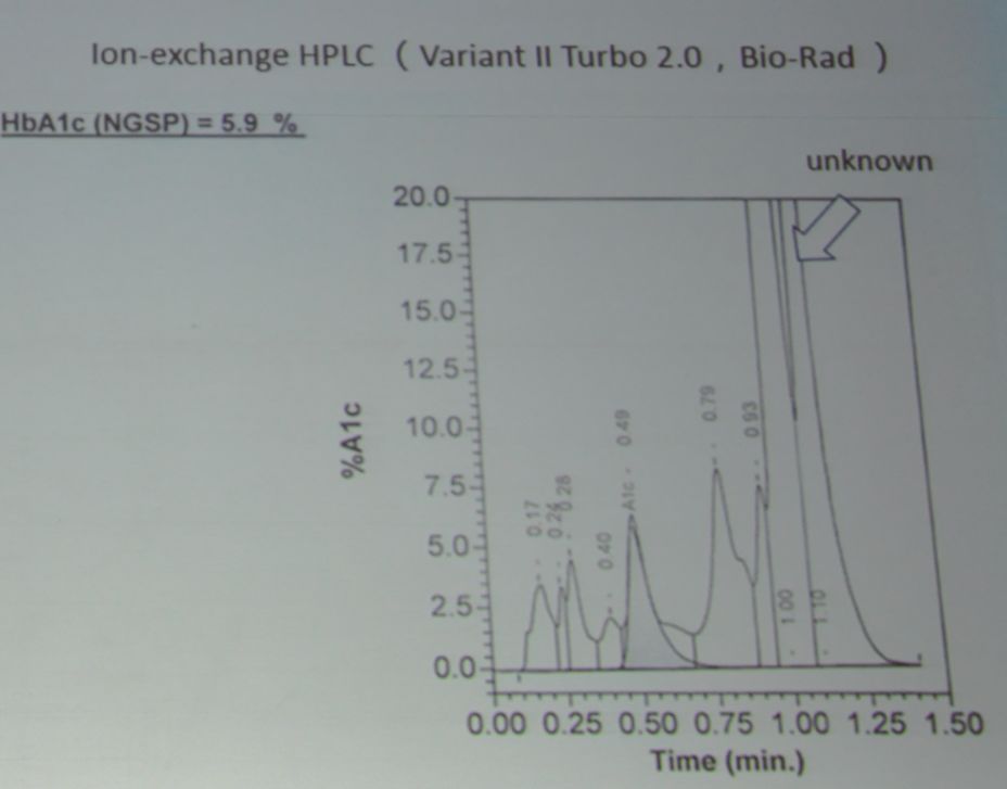 周翔海教授:糖化血红蛋白测量值不准确可能与这些因素有关|PUDF2019