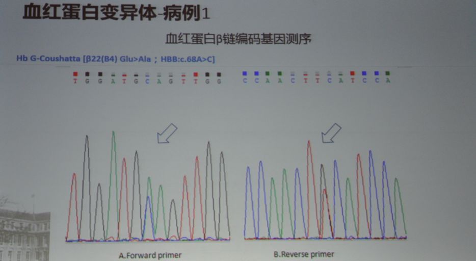糖化血红蛋白测定会有误差吗,糖化血红蛋白分析误差大吗