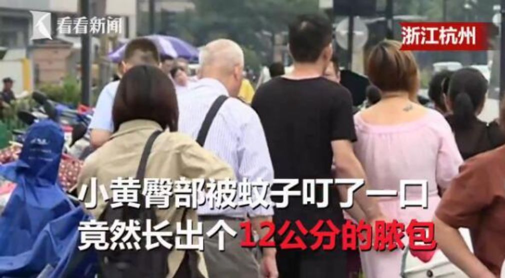 泰国青草膏驱蚊止痒防蚊虫叮咬,泰国蚊子叮咬止痒膏