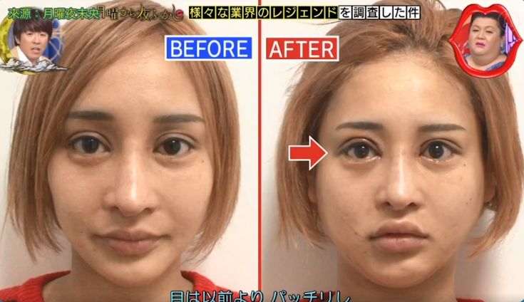 日本整形医生石原里美,石原里美脸部变美技巧