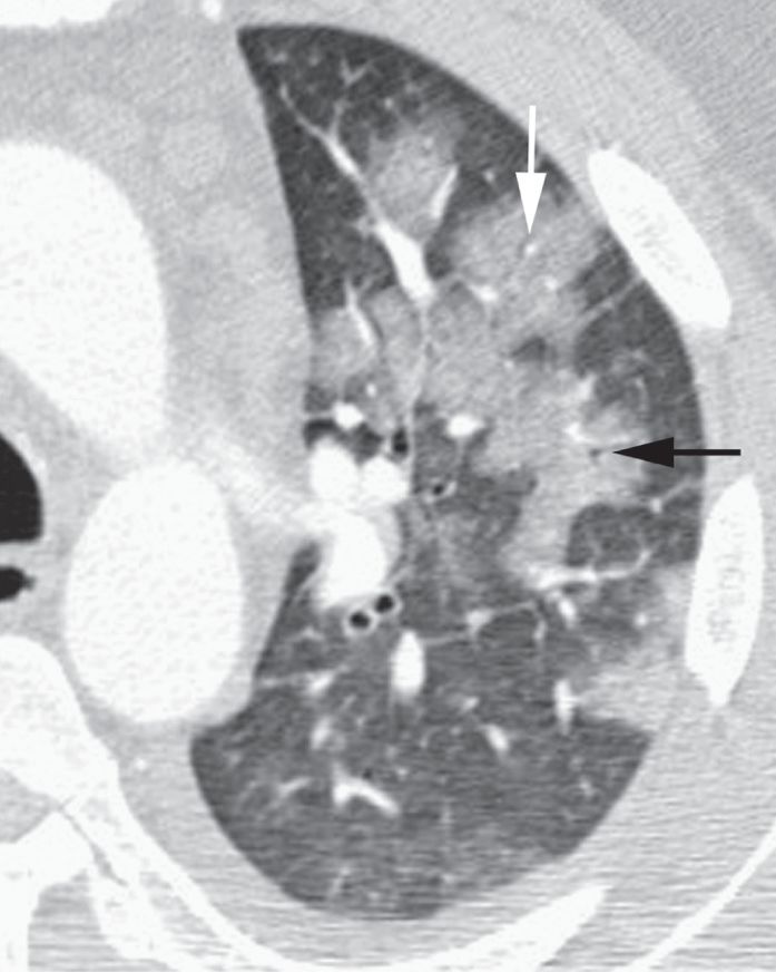 认识肺部的目的,认识呼吸器官知识点