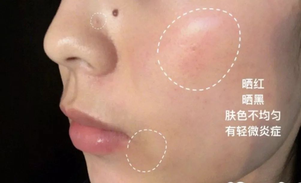 有必要用哪一款水乳,一辈子就能用一套水乳