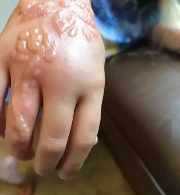 “日本制造”又曝丑闻!违禁成分泛滥,却还有1亿中国人疯抢