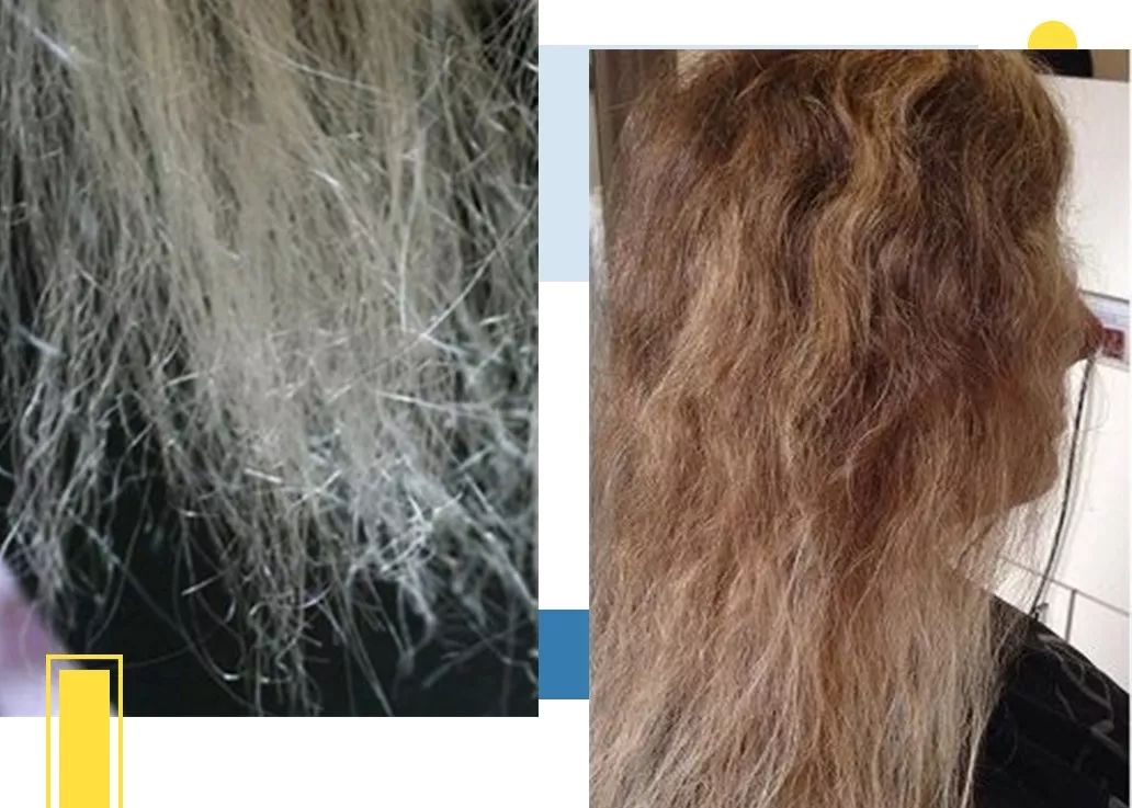 洗了这么多年的头你真的洗对了吗,洗了那么久的脸居然洗错了