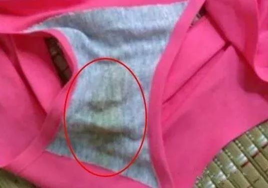怎样去除女裤内裆异味,女性裤子裆部有异味怎么办