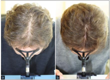 想要「换发型等于换头」？看这简单3步就可以