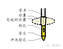 尿管只是导尿的吗？丨朝花夕拾·协和八