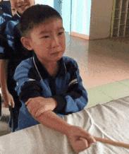 胳膊上的小圆疤是什么,手臂的疤是怎么形成的