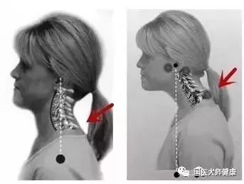 紧急提醒已进入高发期,紧急提示后市需要留意什么