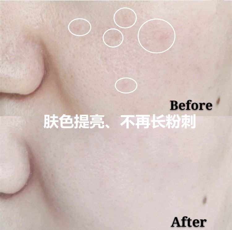 可以变白的维c推荐,维c既美白又抗老