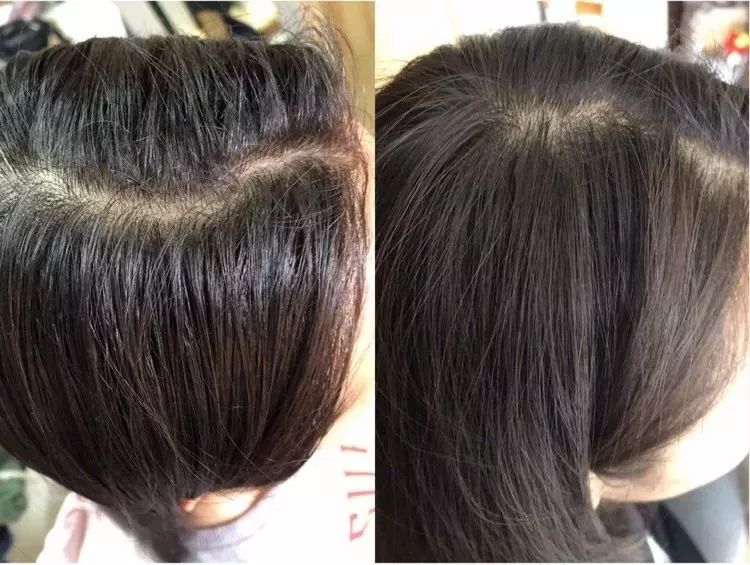 团|你的头发一根都不许掉!用它,还能3天不洗头依然干爽不油腻