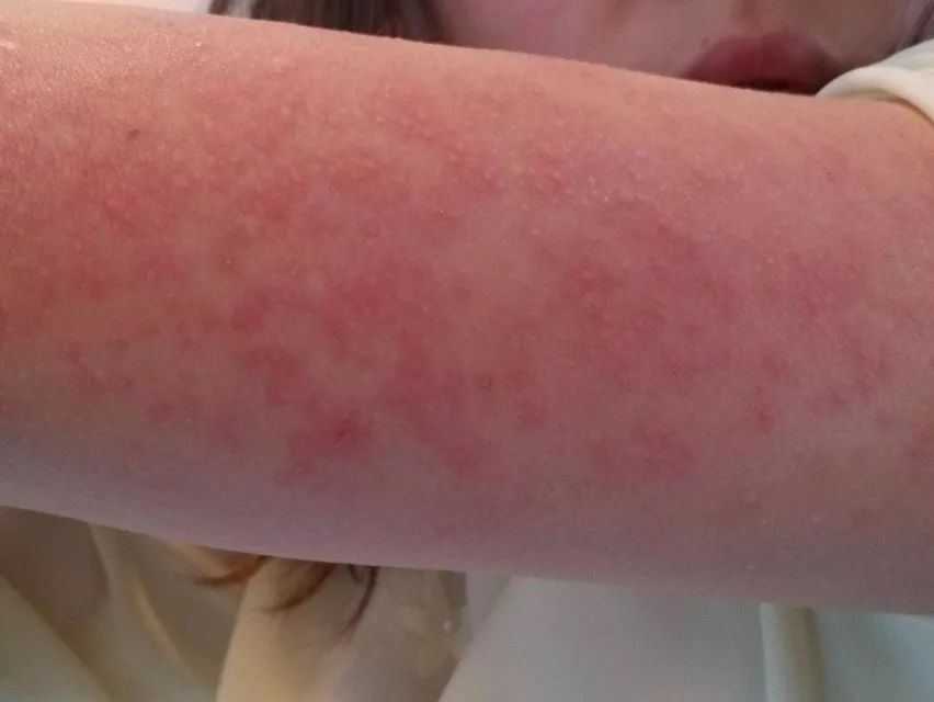 洗衣机加水有臭味怎么办,洗衣机污垢和霉菌