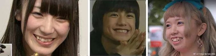 抖音卖爆电动牙刷,卖爆了的牙刷