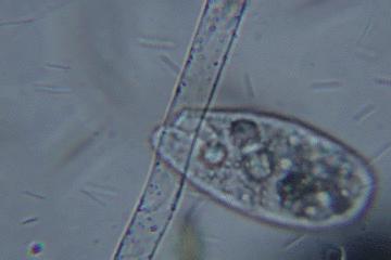 水中常见的藻类微生物图片,藏在水下的生物