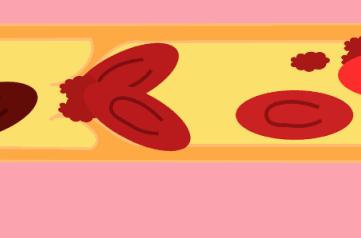 血液循环差怎么调理,血液循环不好容易引起哪些疾病