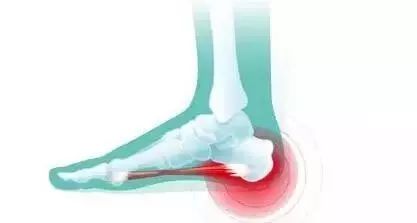 脚后底板疼是怎么回事,脚底板疼是怎么回事小学生